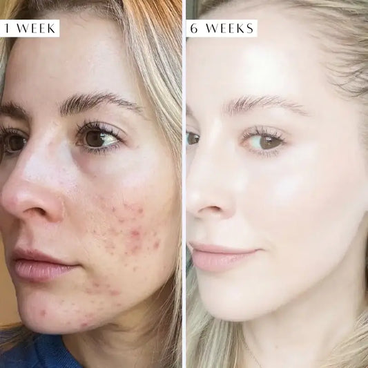 Suplements Tomiko Gluta